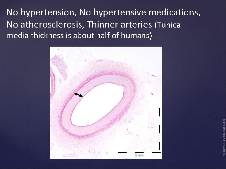 No hypertension, No hypertensive medications, No atherosclerosis, Thinner arteries (Tunica PI-136107 -AA Jan 2013