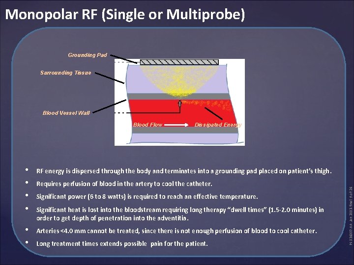 Monopolar RF (Single or Multiprobe) Grounding Pad Surrounding Tissue Blood Vessel Wall Dissipated Energy