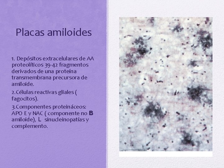 Placas amiloides 1. Depósitos extracelulares de AA proteolíticos 39 -42 fragmentos derivados de una