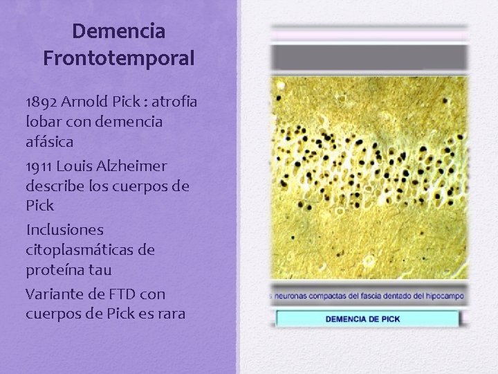 Demencia Frontotemporal 1892 Arnold Pick : atrofia lobar con demencia afásica 1911 Louis Alzheimer