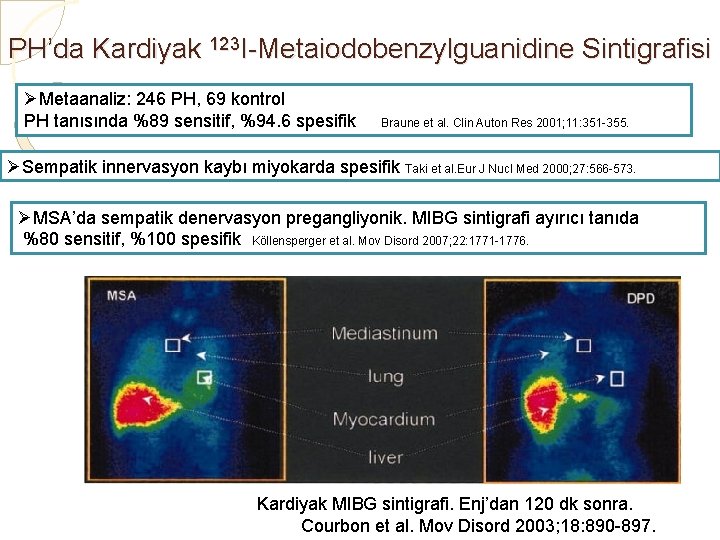 PH’da Kardiyak 123 I-Metaiodobenzylguanidine Sintigrafisi ØMetaanaliz: 246 PH, 69 kontrol PH tanısında %89 sensitif,