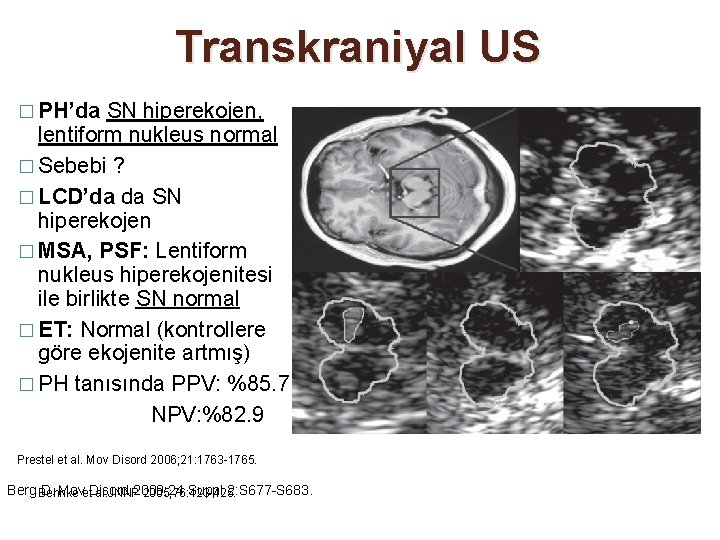 Transkraniyal US � PH’da SN hiperekojen, lentiform nukleus normal � Sebebi ? � LCD’da