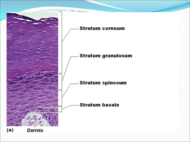 Stratum corneum Stratum granulosum Stratum spinosum Stratum basale (a) Dermis 