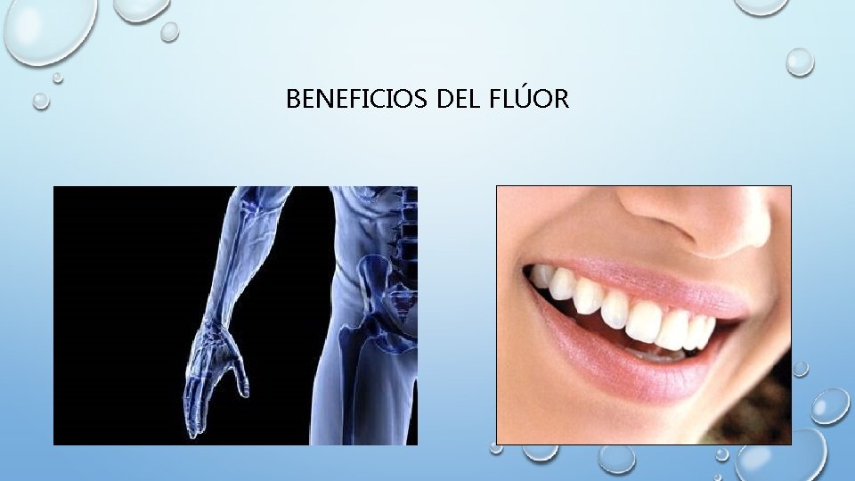 BENEFICIOS DEL FLÚOR 
