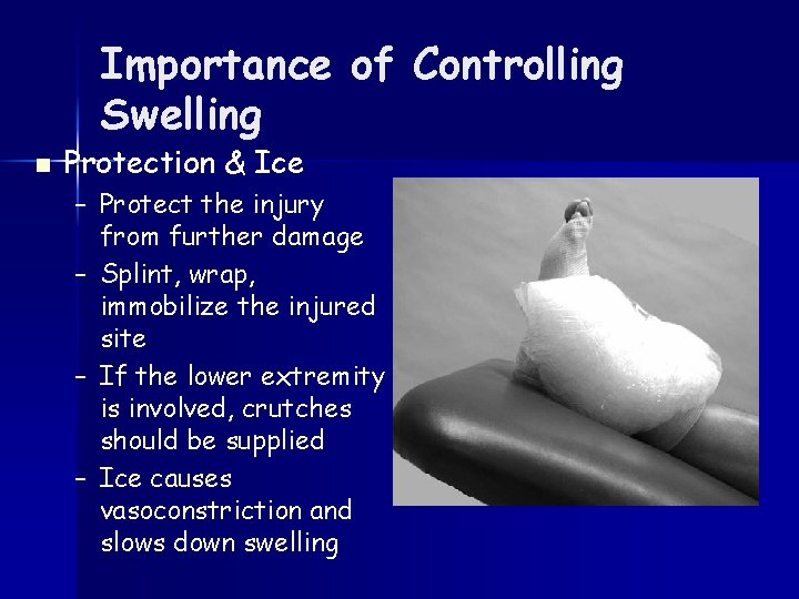 Importance of Controlling Swelling n Protection & Ice – Protect the injury from further