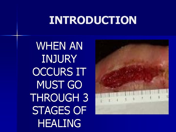 INTRODUCTION WHEN AN INJURY OCCURS IT MUST GO THROUGH 3 STAGES OF HEALING 