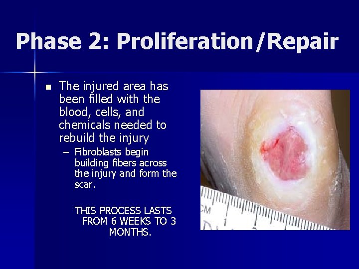 Phase 2: Proliferation/Repair n The injured area has been filled with the blood, cells,