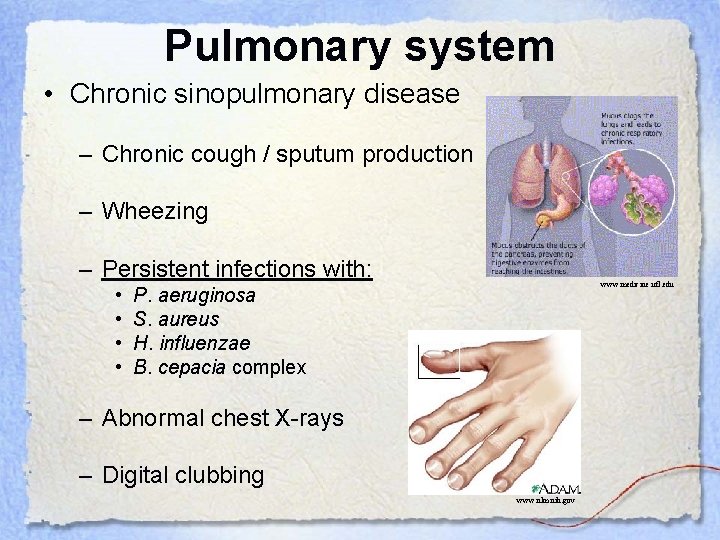 Pulmonary system • Chronic sinopulmonary disease – Chronic cough / sputum production – Wheezing
