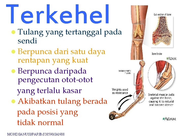 Terkehel l Tulang yang tertanggal pada sendi l Berpunca dari satu daya rentapan yang Terkehel l Tulang yang tertanggal pada sendi l Berpunca dari satu daya rentapan yang