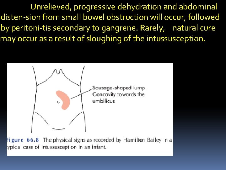 Unrelieved, progressive dehydration and abdominal disten-sion from small bowel obstruction will occur, followed by