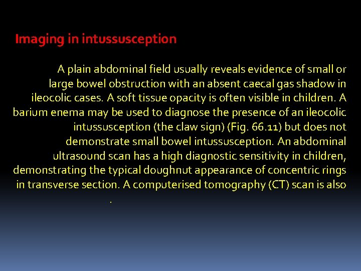 Imaging in intussusception A plain abdominal field usually reveals evidence of small or large