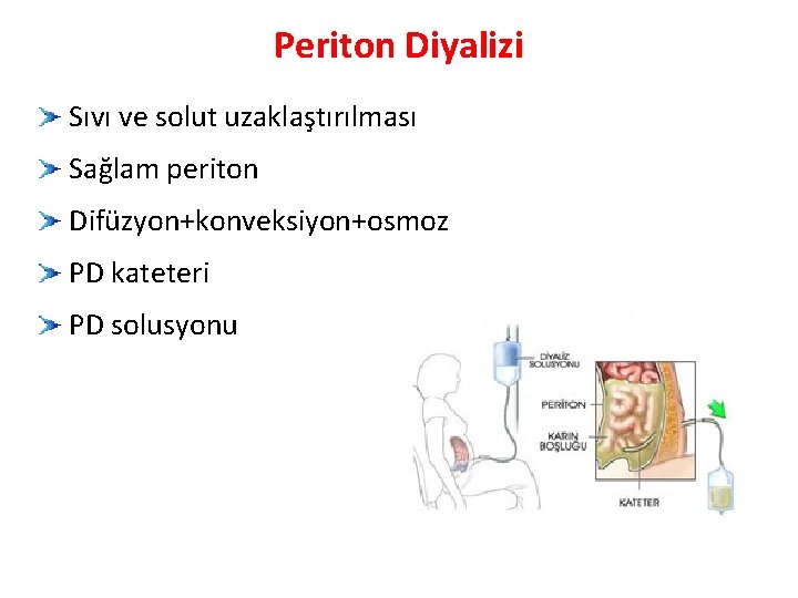 Periton Diyalizi Sıvı ve solut uzaklaştırılması Sağlam periton Difüzyon+konveksiyon+osmoz PD kateteri PD solusyonu 