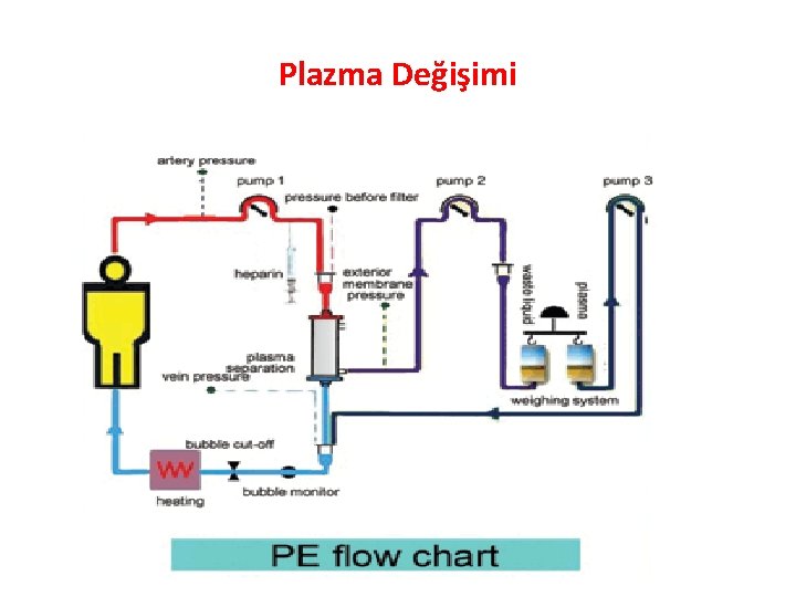 Plazma Değişimi 