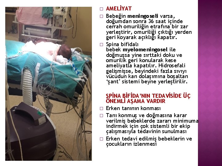 � � � AMELİYAT Bebeğin meningoseli varsa, doğumdan sonra 36 saat içinde cerrah omuriliğin