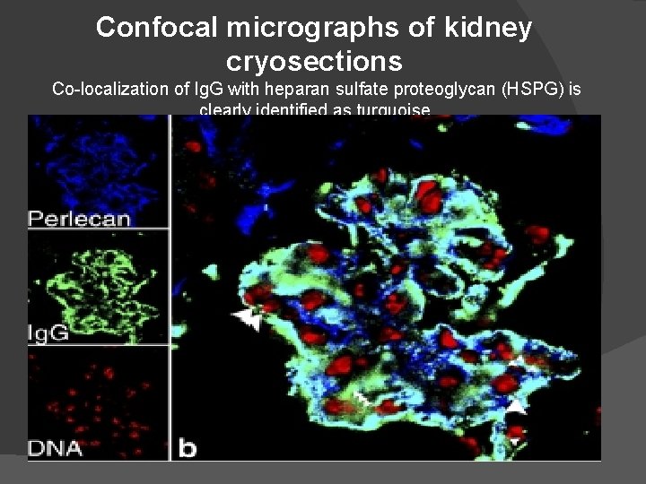 Confocal micrographs of kidney cryosections Co-localization of Ig. G with heparan sulfate proteoglycan (HSPG)