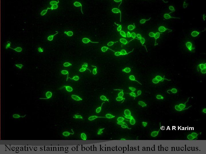 Negative staining of both kinetoplast and the nucleus. 