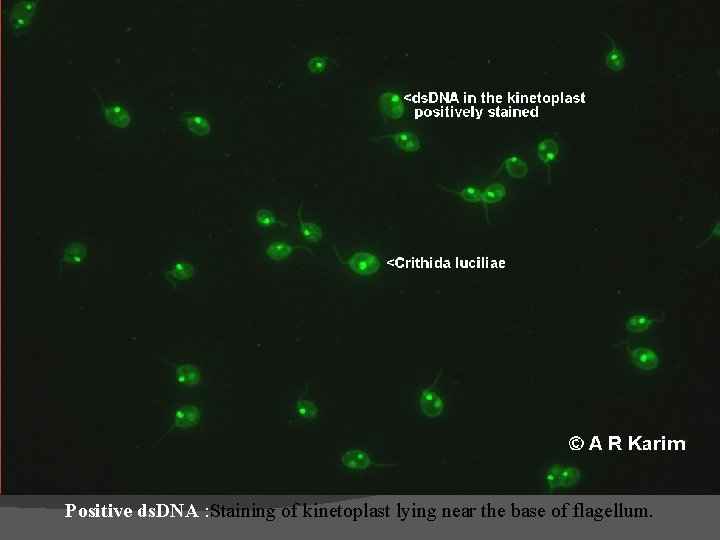 Positive ds. DNA : Staining of kinetoplast lying near the base of flagellum. 