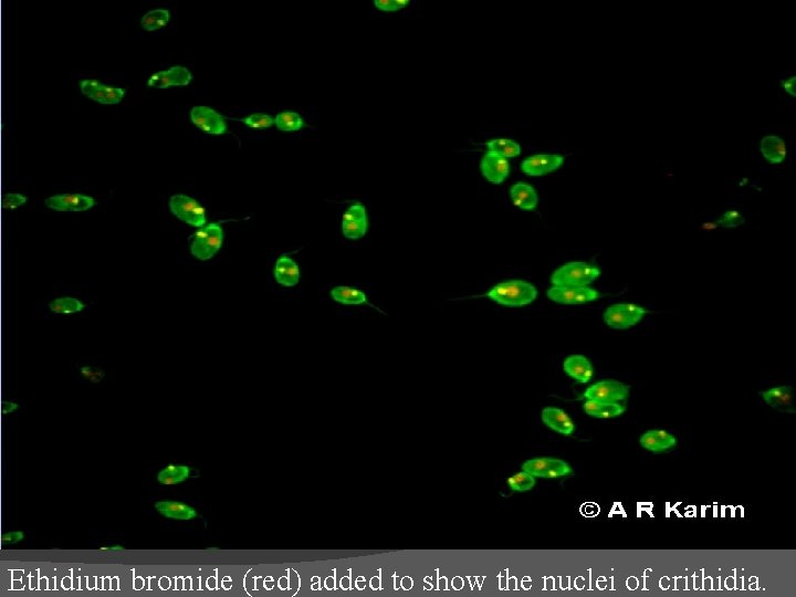 Ethidium bromide (red) added to show the nuclei of crithidia. 