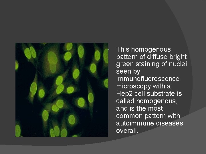  This homogenous pattern of diffuse bright green staining of nuclei seen by immunofluorescence