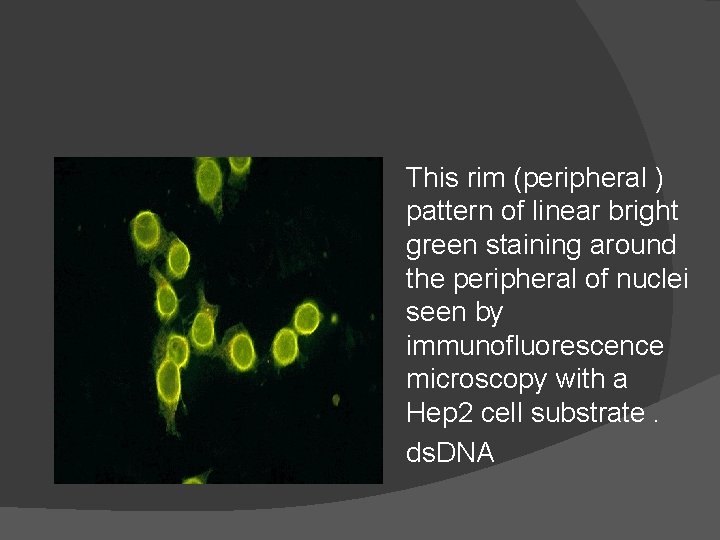 This rim (peripheral ) pattern of linear bright green staining around the peripheral of