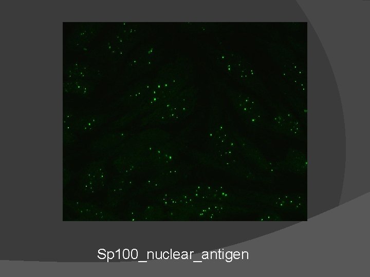 Sp 100_nuclear_antigen 