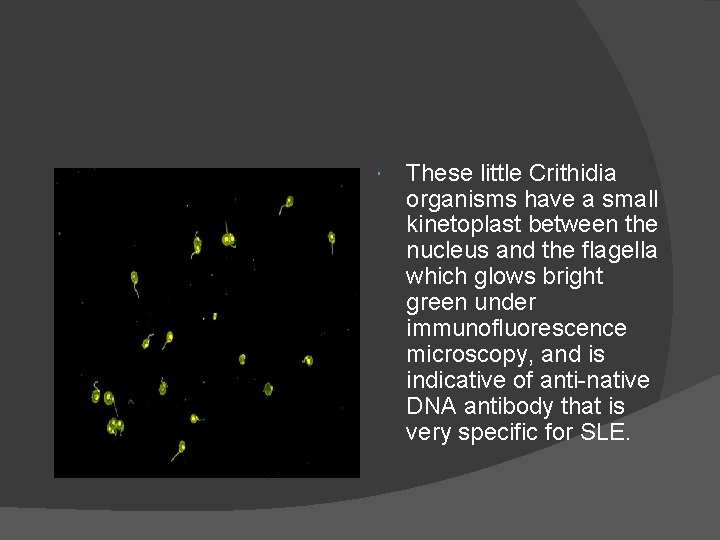  These little Crithidia organisms have a small kinetoplast between the nucleus and the