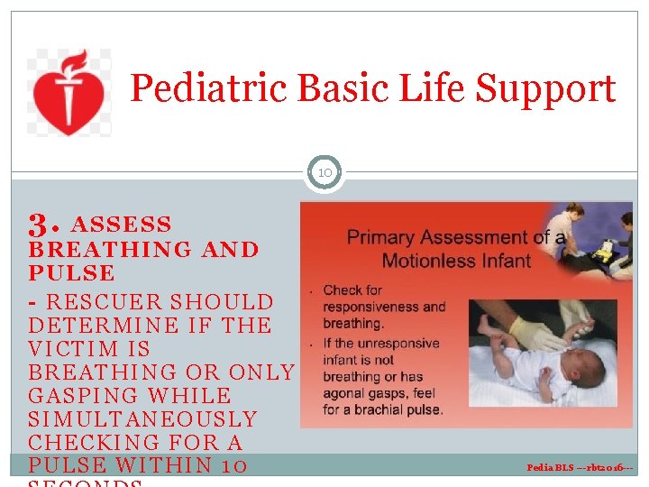 Pediatric Basic Life Support 10 3. ASSESS BREATHING AND PULSE - RESCUER SHOULD DETERMINE Pediatric Basic Life Support 10 3. ASSESS BREATHING AND PULSE - RESCUER SHOULD DETERMINE