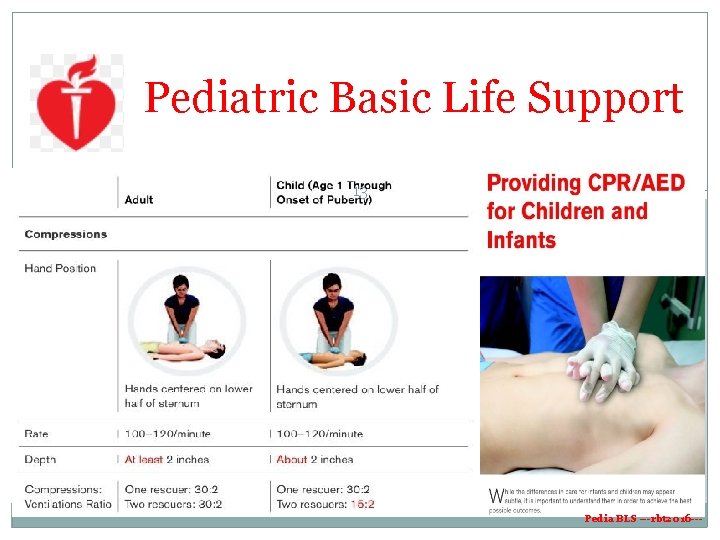 Pediatric Basic Life Support 13 Pedia BLS ---rbt 2016 --- Pediatric Basic Life Support 13 Pedia BLS ---rbt 2016 ---