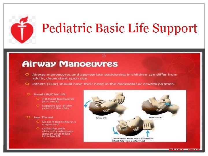 Pediatric Basic Life Support 15 Pedia BLS ---rbt 2016 --- Pediatric Basic Life Support 15 Pedia BLS ---rbt 2016 ---
