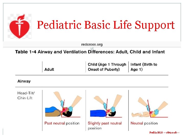 Pediatric Basic Life Support 16 Pedia BLS ---rbt 2016 --- Pediatric Basic Life Support 16 Pedia BLS ---rbt 2016 ---