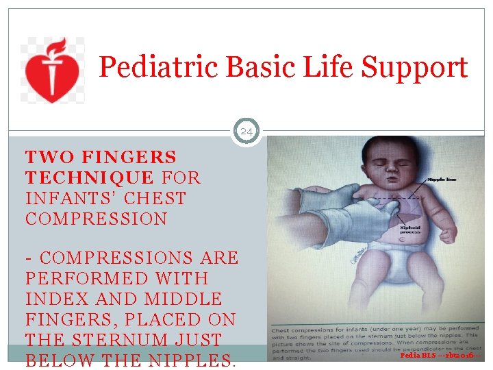 Pediatric Basic Life Support 24 TWO FIN GERS TECHNIQ UE FOR INFANT S’ CHEST Pediatric Basic Life Support 24 TWO FIN GERS TECHNIQ UE FOR INFANT S’ CHEST