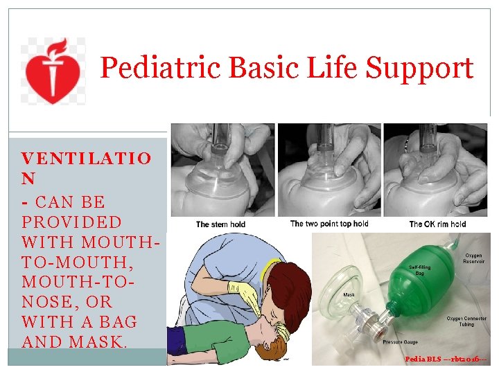 Pediatric Basic Life Support 27 VENTILATIO N - CAN BE PROVIDED WITH MOUTHTO-MOUTH, MOUTH-TONOSE, Pediatric Basic Life Support 27 VENTILATIO N - CAN BE PROVIDED WITH MOUTHTO-MOUTH, MOUTH-TONOSE,