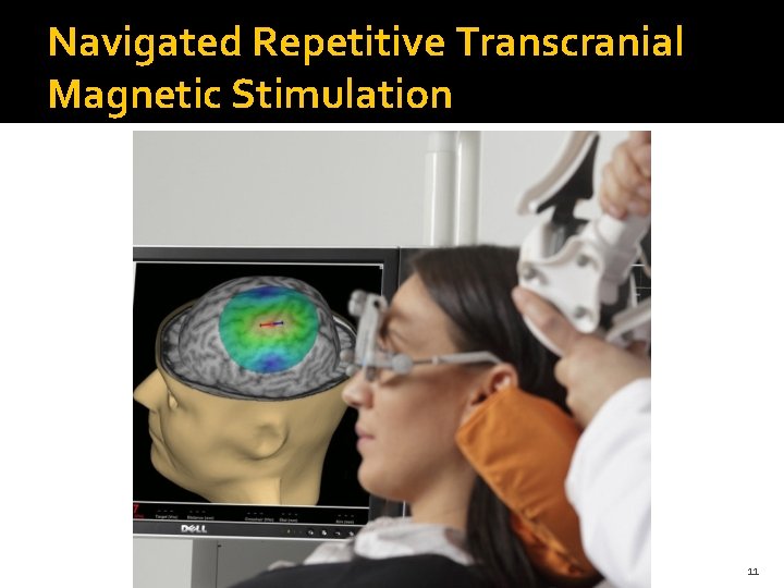 Navigated Repetitive Transcranial Magnetic Stimulation 11 