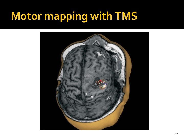 Motor mapping with TMS 12 