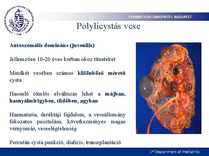 SEMMELWEIS UNIVERSITY, BUDAPEST Polylicystás vese Autoszómális domináns (juvenilis) Jellemzően 10 -20 éves korban okoz