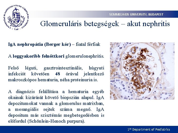 SEMMELWEIS UNIVERSITY, BUDAPEST Glomeruláris betegségek – akut nephritis Ig. A nephropátia (Berger kór) –