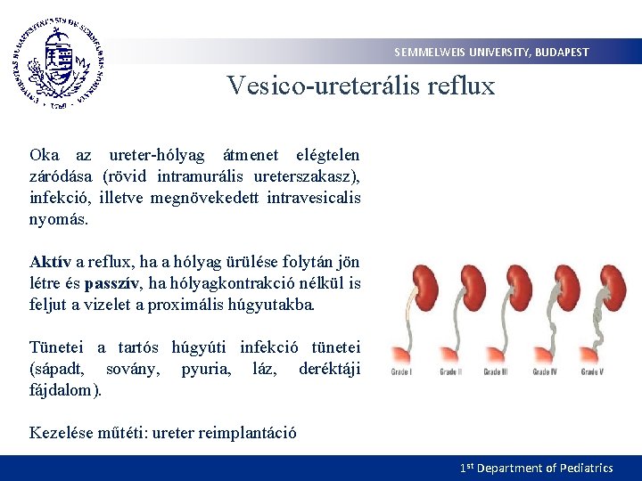 SEMMELWEIS UNIVERSITY, BUDAPEST Vesico-ureterális reflux Oka az ureter-hólyag átmenet elégtelen záródása (rövid intramurális ureterszakasz),