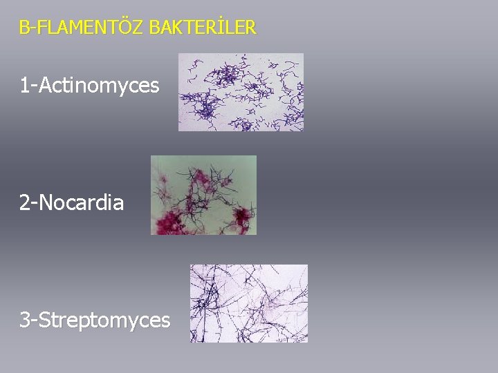 B-FLAMENTÖZ BAKTERİLER 1 -Actinomyces 2 -Nocardia 3 -Streptomyces 