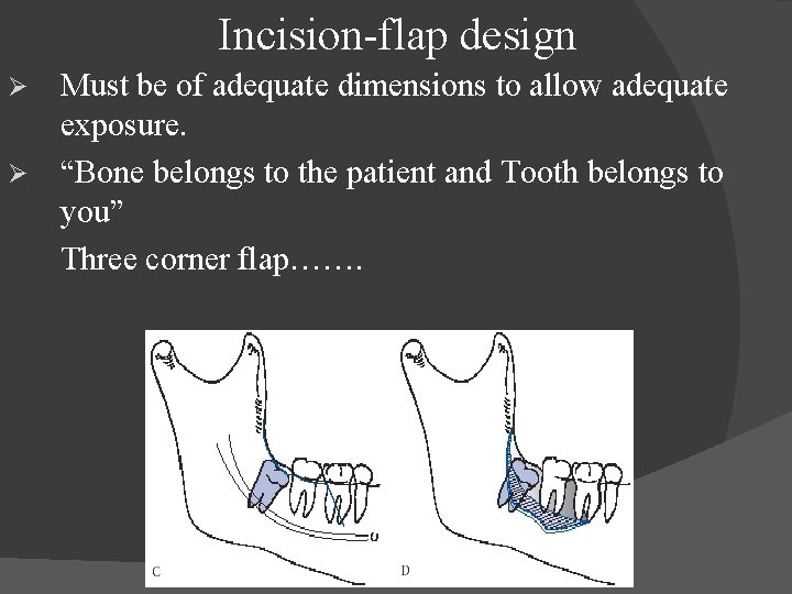  Incision-flap design Must be of adequate dimensions to allow adequate exposure. Ø “Bone