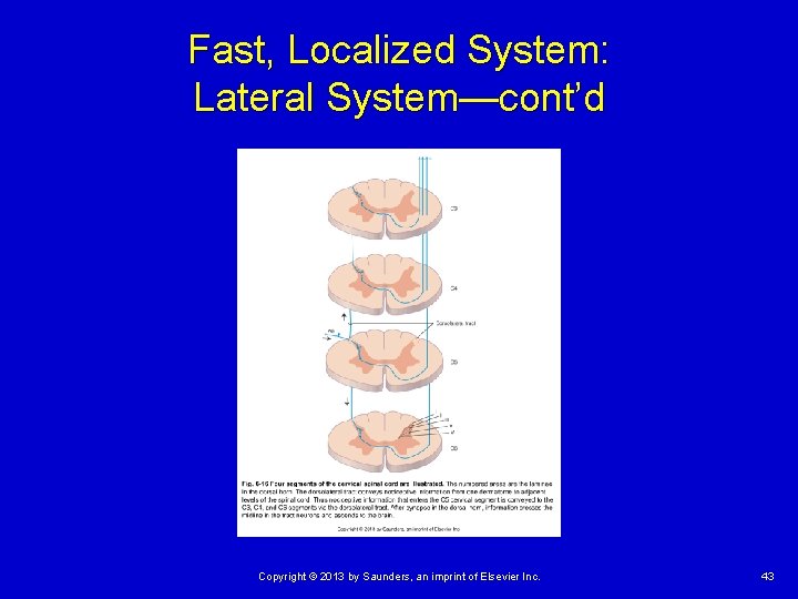 Fast, Localized System: Lateral System—cont’d Copyright © 2013 by Saunders, an imprint of Elsevier