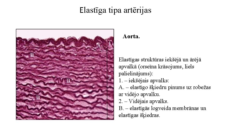Elastīga tipa artērijas Aorta. Elastīgas struktūras iekšējā un ārējā apvalkā (orseīna krāsojums, liels palielinājums):