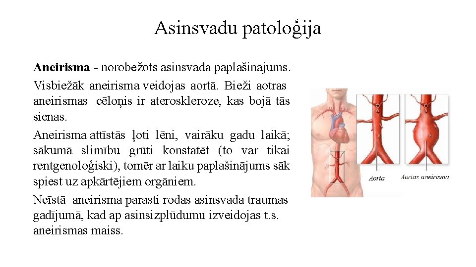 Asinsvadu patoloģija Aneirisma - norobežots asinsvada paplašinājums. Visbiežāk aneirisma veidojas aortā. Bieži aotras aneirismas