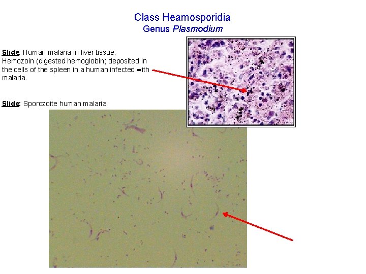 Class Heamosporidia Genus Plasmodium Slide: Human malaria in liver tissue: Hemozoin (digested hemoglobin) deposited