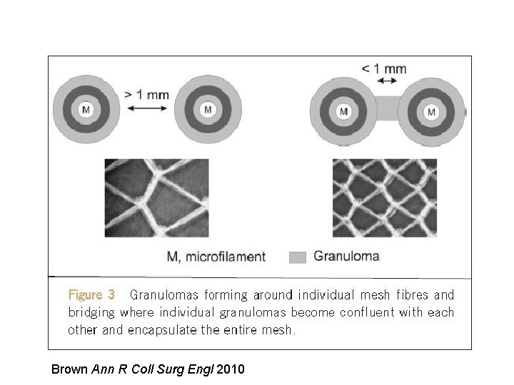 Brown Ann R Coll Surg Engl 2010 