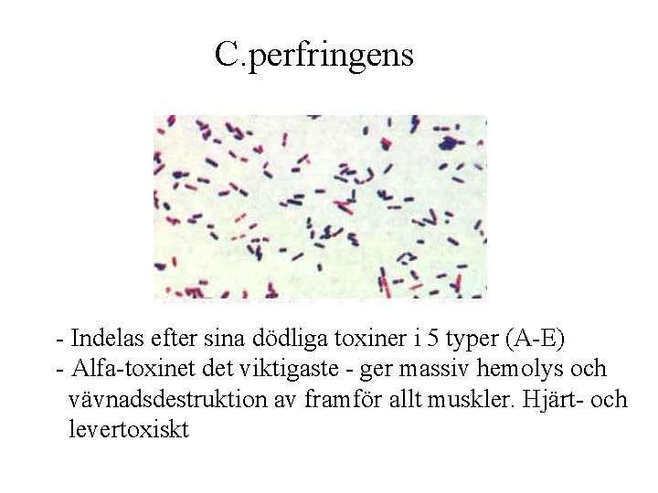 C. perfringens - Indelas efter sina dödliga toxiner i 5 typer (A-E) - Alfa-toxinet