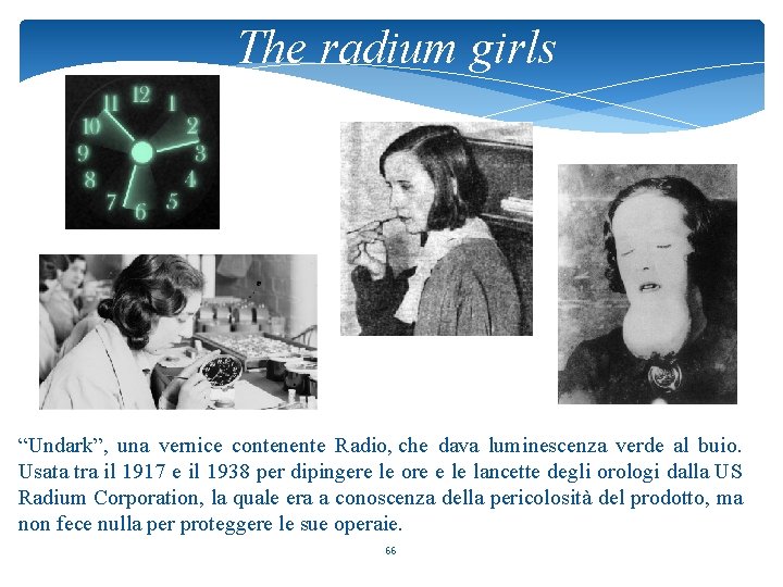 The radium girls “Undark”, una vernice contenente Radio, che dava luminescenza verde al buio.