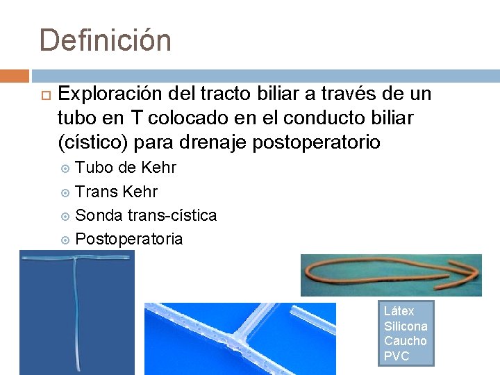 Definición Exploración del tracto biliar a través de un tubo en T colocado en
