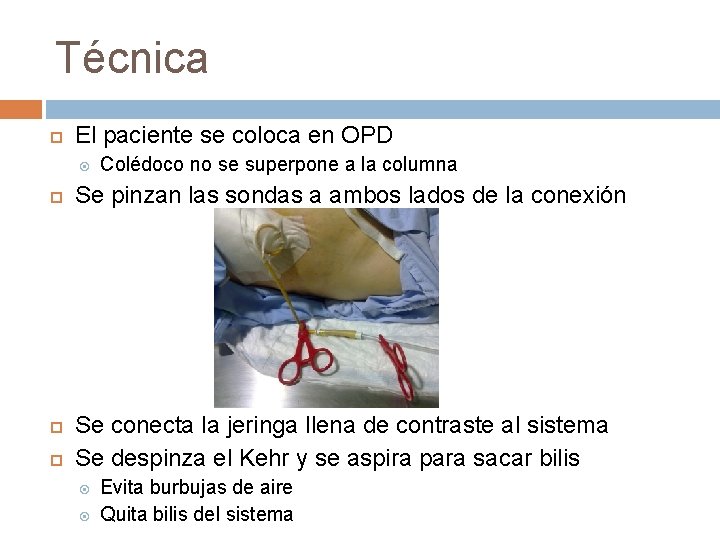 Técnica El paciente se coloca en OPD Colédoco no se superpone a la columna