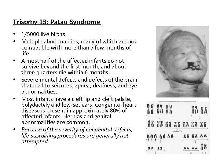 Trisomy 13: Patau Syndrome • 1/5000 live births • Multiple abnormalities, many of which