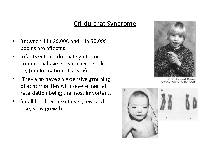 Cri-du-chat Syndrome • Between 1 in 20, 000 and 1 in 50, 000 babies